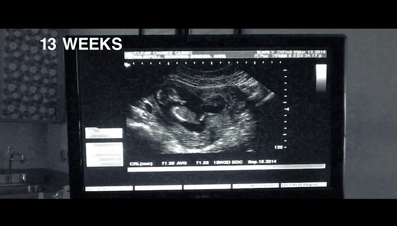 What If the Unborn Could Talk? A Beautiful Video With a Powerful Message