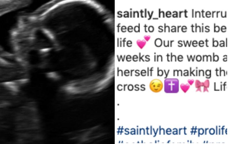 Unborn Baby Makes Sign of the Cross in Fascinating Sonogram Image - See the Photo Here!